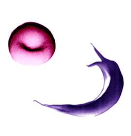 An oxygenated red blood cell is disc-shaped and flexible. A red blood cell in a sickle disease patient, when not carrying oxygen, forms a larger, rigid sickle shape.